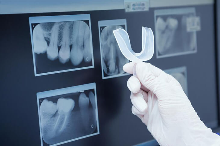 orthodontic disorders