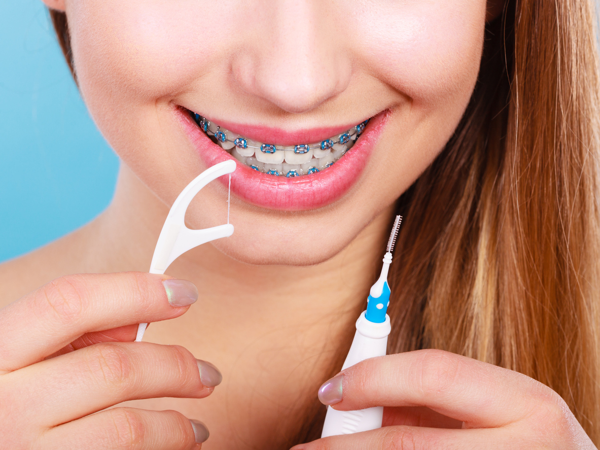 Stock image of a girl flossing teeth with braces.