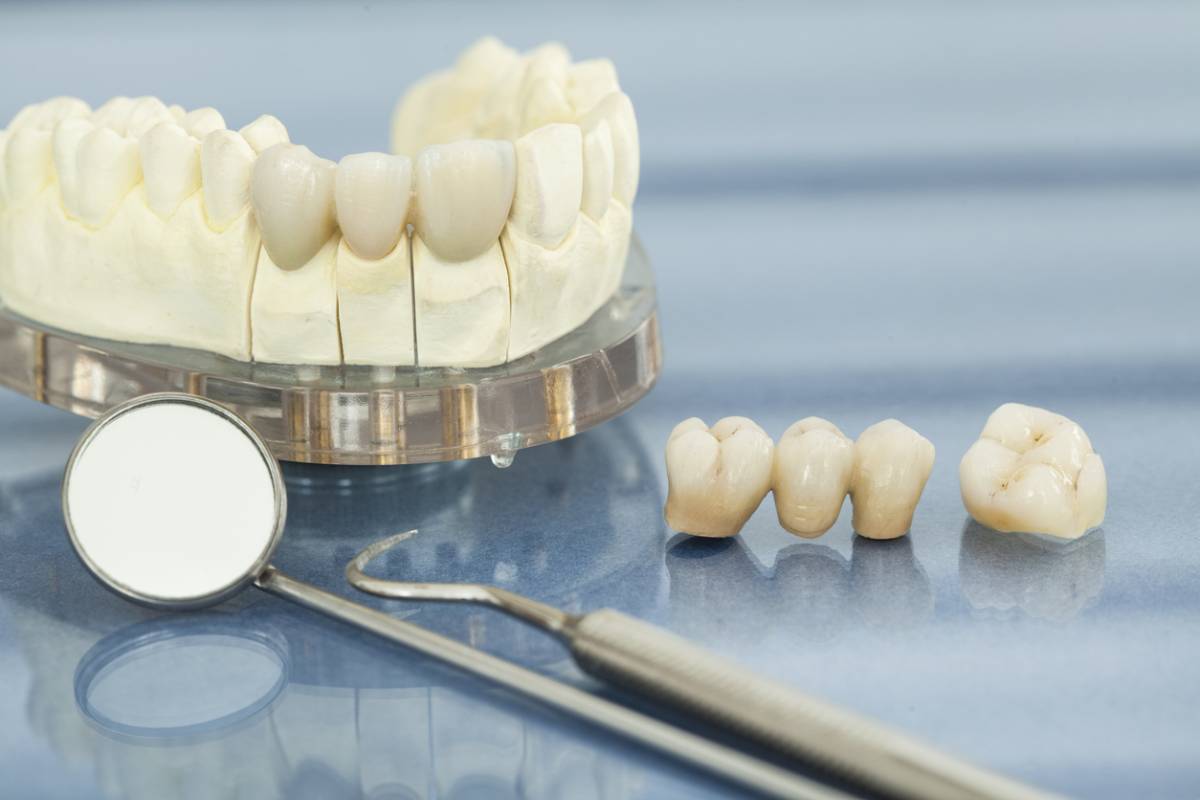Stock image of lower dental set