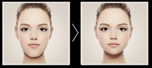 Image showing before and after Facial Trauma treatment