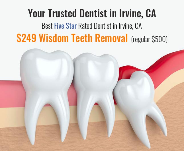 Image showing Wisdom teeth removal discounted price