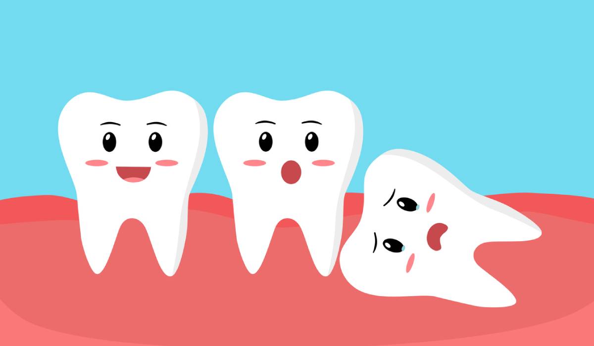 concept of wisdom teeth pain needing removal
