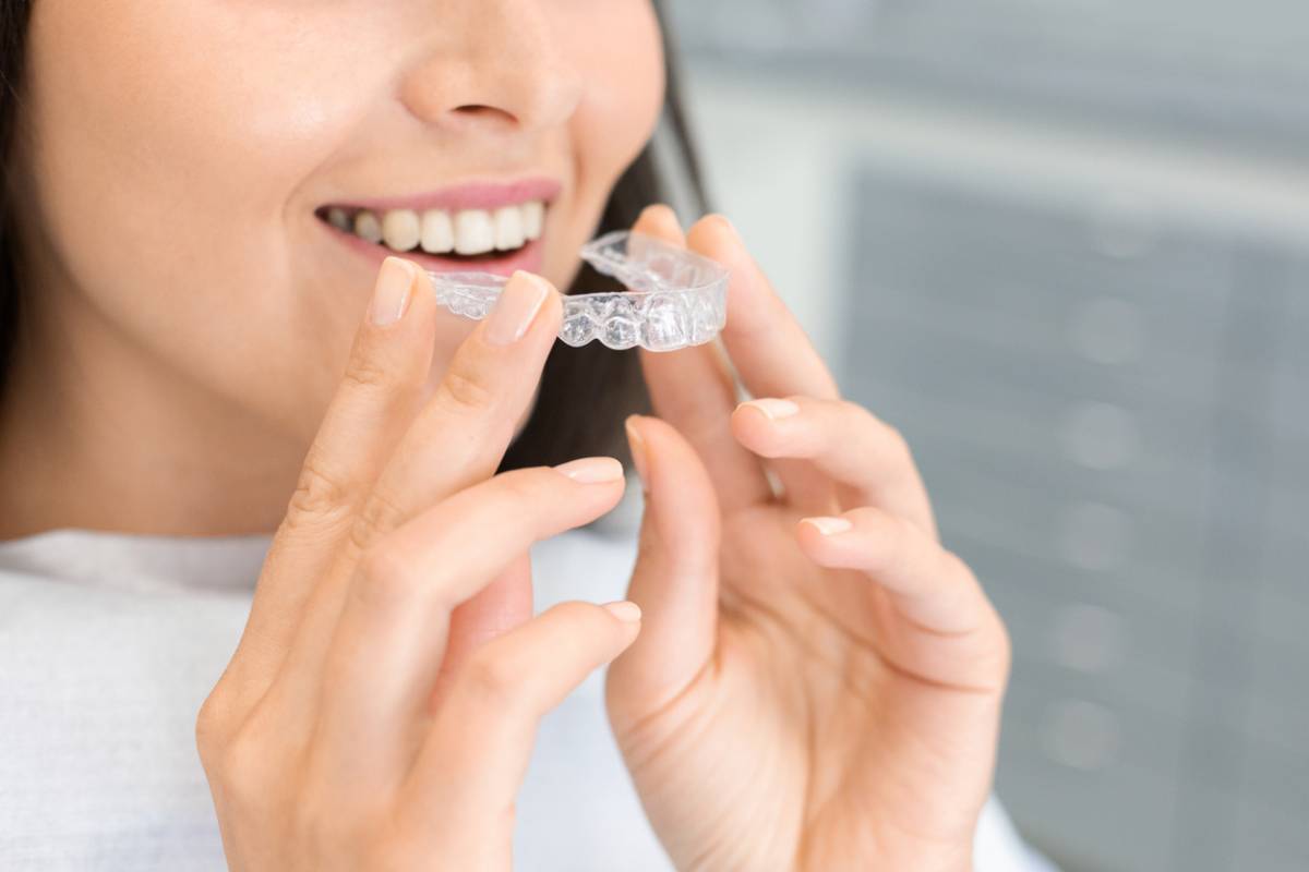 Featured image for How Long Will I Need to Wear My Invisalign Aligners?
