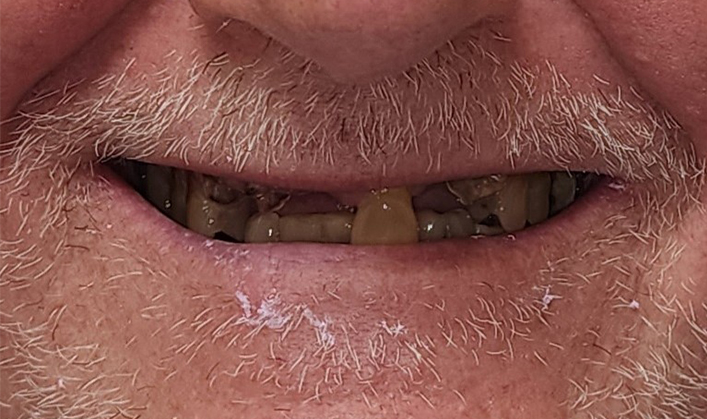 Before image