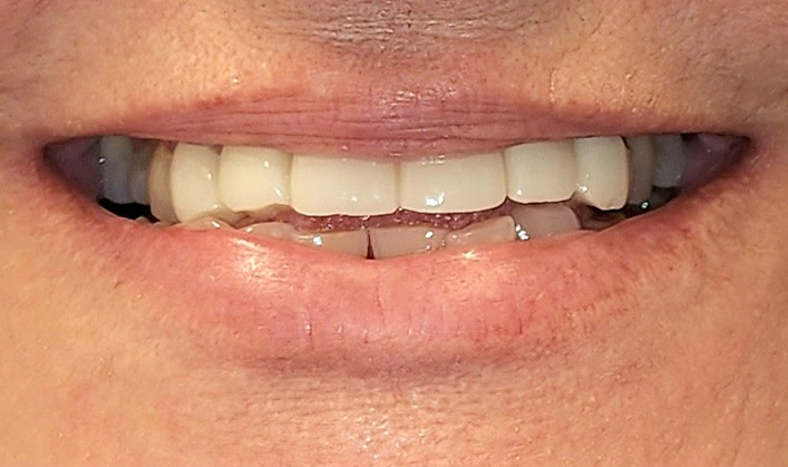 Before image
