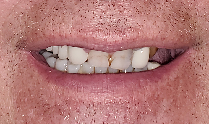 Before image