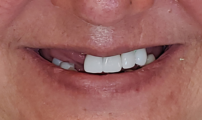Before image