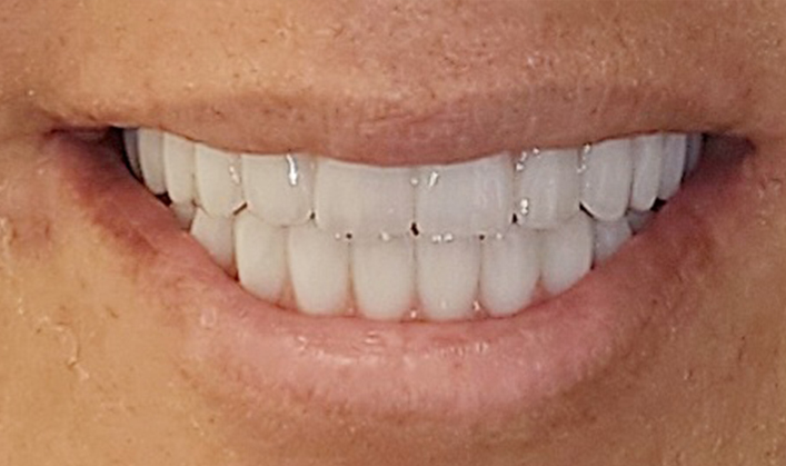 After image