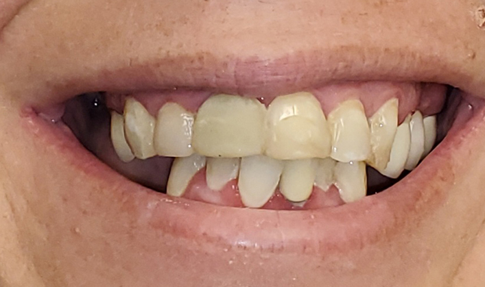 Before image